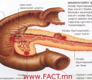 НОЙР БУЛЧИРХАЙ