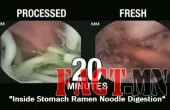 Inside-Stomach-Ramen-Noodle-Digestion