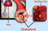 cholesterol_heart_disease