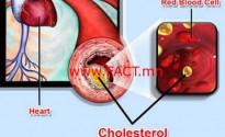 cholesterol_heart_disease